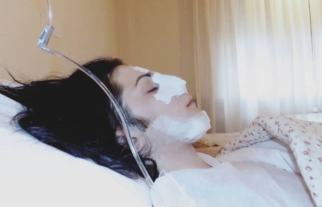 Michael Jackson'a benzemek için 40 bin dolar harcadı! Bakın neye benzedi... 4